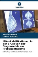 Mikrokalzifikationen In Der Brust Von Der Diagnose Bis Zur Probenentnahme Radia