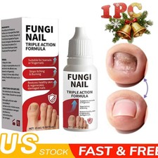Fungi-Nail Anti-Fungal Liquid Solution Kills Fungus That Can Lead To Nail