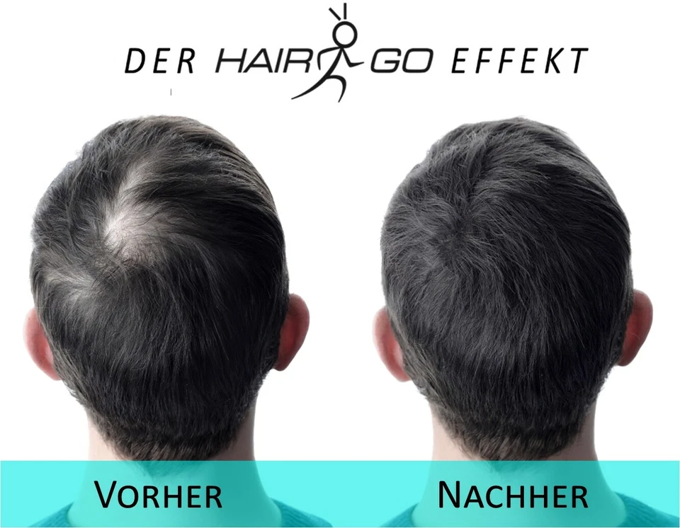 Haarverdichter HAIR GO Premium Streuhaar Schütthaar Hairfor2 Haarausfall - Bild 4 von 4