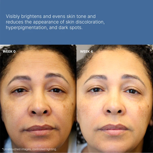 NuSkin Nu Skin ageLOC Tru Face Peptide Retinol Complex - NEW PRODUCT - 09/2027 - Image 3 of 4