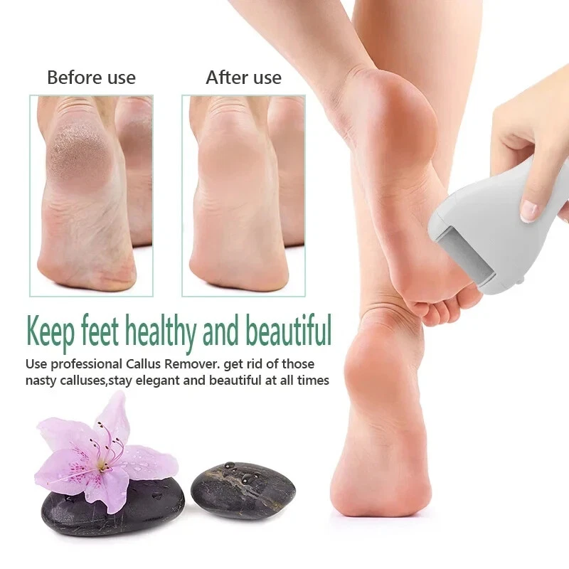 Electric Pedicure Foot File USB Rechargeable Power Display 3 Grinding Exfoliator - Image 4 of 4
