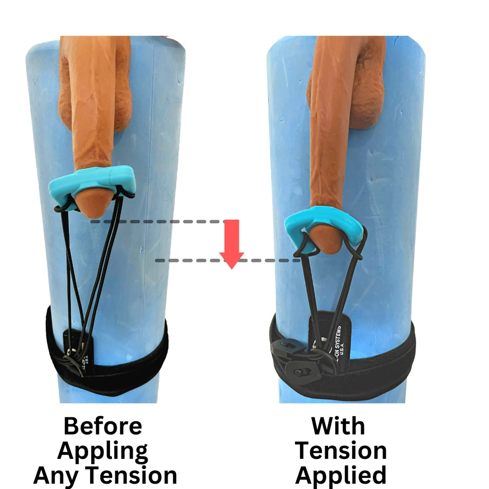 Extensor de estiramiento de pene May 2024 - Dispositivo de estiramiento de pene - Ajuste universal 2024 Foto 4 de 4