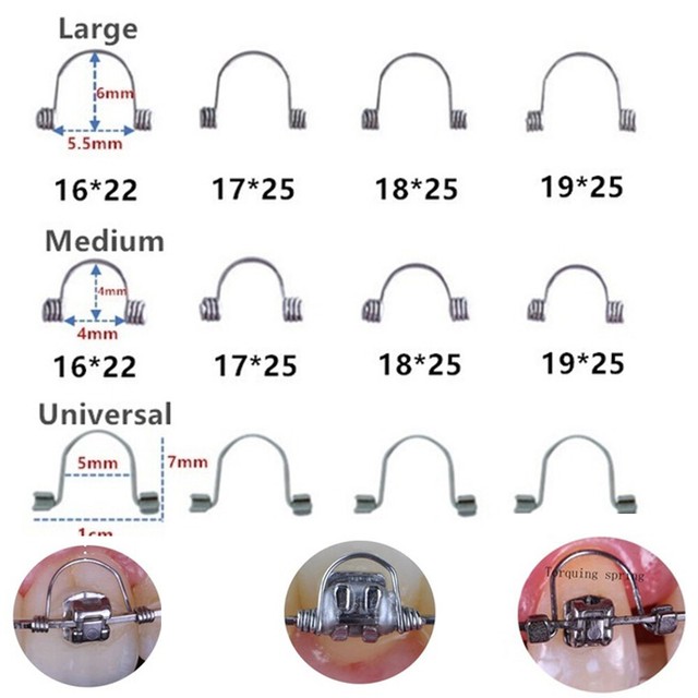 Dental Torquing Spring Orthodontic Arch wire Anterior Teeth Wire Large