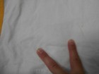 Bild 3 von 11