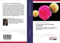 El Carcinoma Oral De CéLulas Escamosas José Vicente BagáN