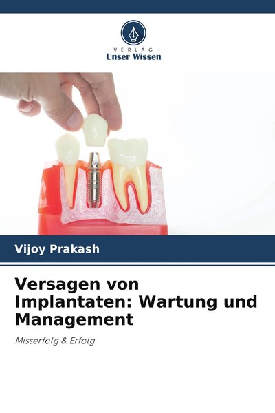 Versagen Von Implantaten: Wartung Und Management Vijoy Prakash-image