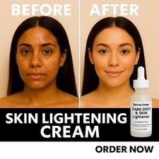 Skin Lightening Cream   Face  Body Dark Spot Corrector   Brightening Serum