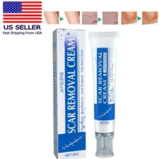 Scar Removal Cream Skin Repair Acne Treatment Fade Stretch Markers Burns