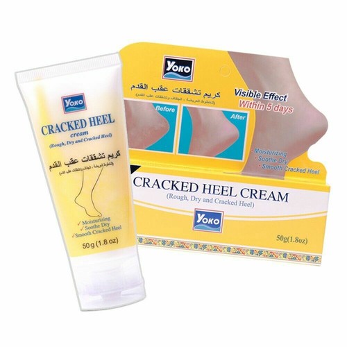 Yoko Cracked Heel Cream, 50 g Cream for 