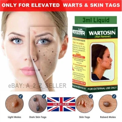 WARTOSIN 🇬🇧**New INDIAN Ayurvedic ONLY ELEVATED Wart Skin tag Help Removal Cream Liquid