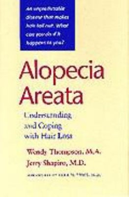 Alopecia Areata : Understanding and Coping with Hair Loss Paperba