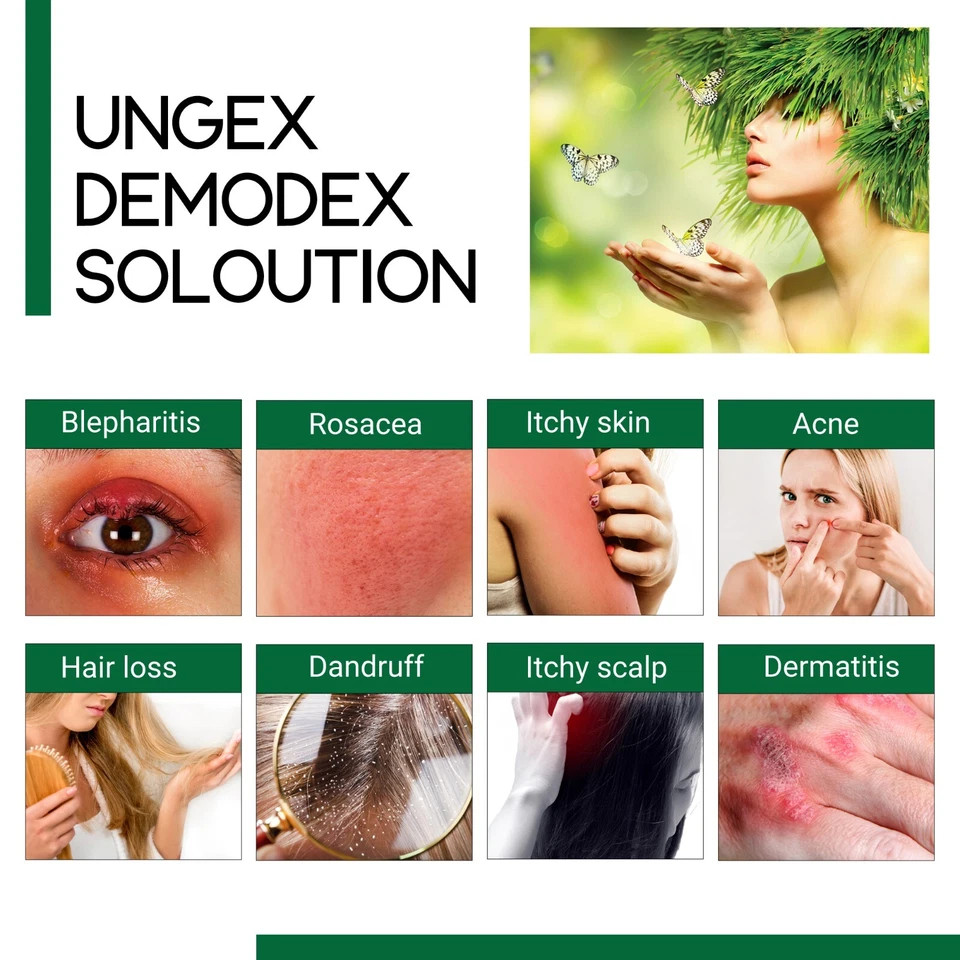 Demodex Defence Cleanser Shampoo for Demodicosis Mites, Acne Rosacea, Dermatitis - Image 3 of 4
