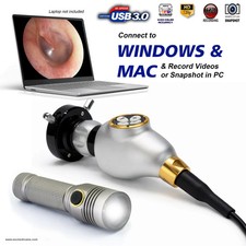 USB Endoscopy Camera HD with Portable LED Light Source for Rigid Endoscopes