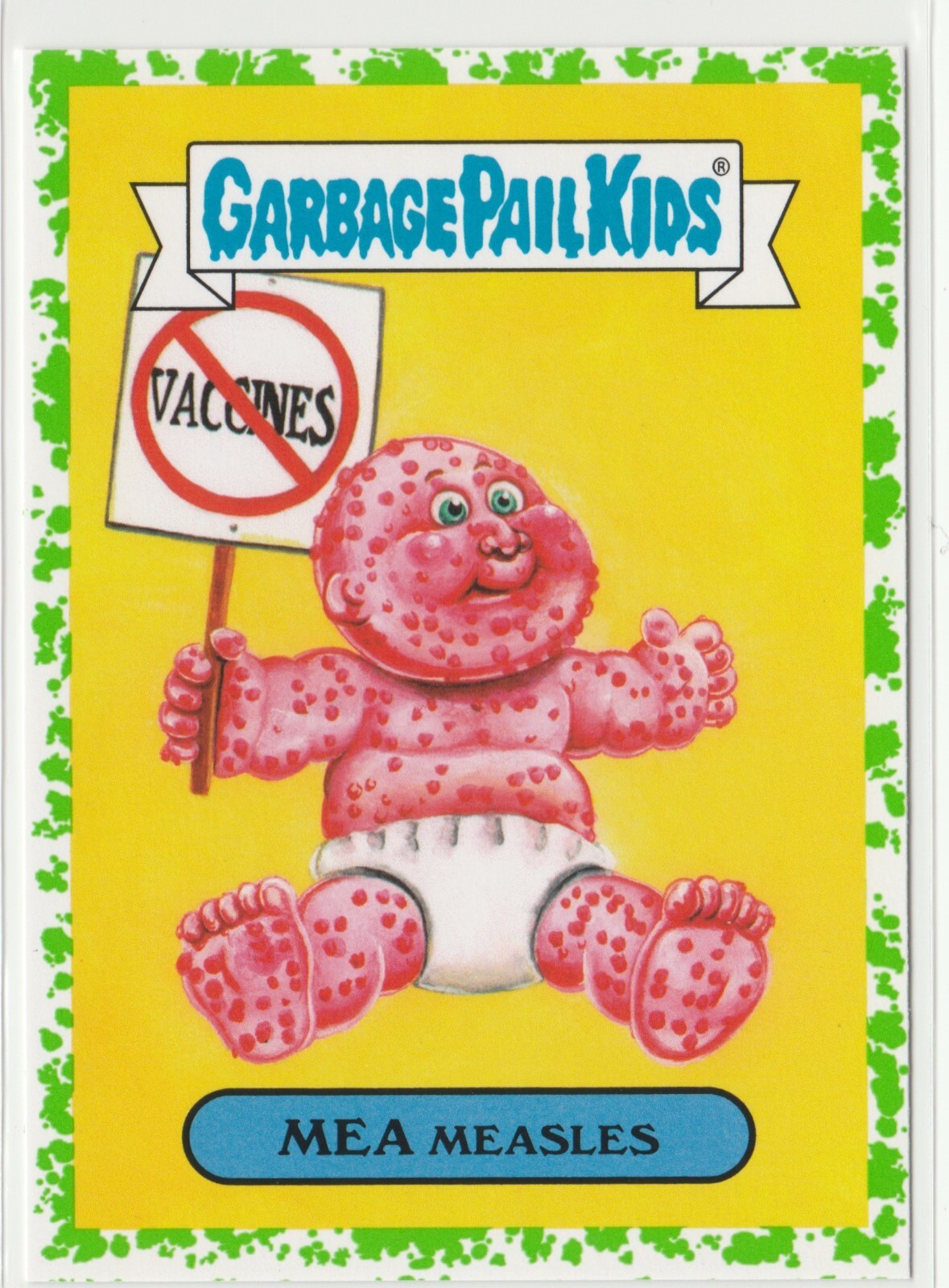 2016 GPK Mea Measles #8b Green Garbage Pail Kids American As Apple Pie