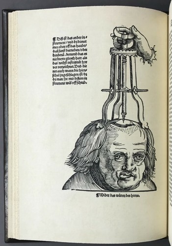 Hans von Gerßdorff Feltbuch Der Wundtartzney Medicina Rara Facsimile 1975 - Picture 6 of 12