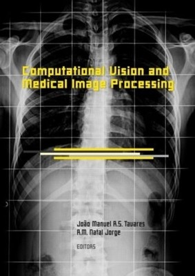 Computational Vision and Medical Image Processing - 9780415457774