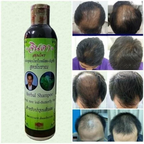 3x Champú natural delgado anti pérdida de cabello fórmula antigua Jinda Herbal Foto 4 de 4