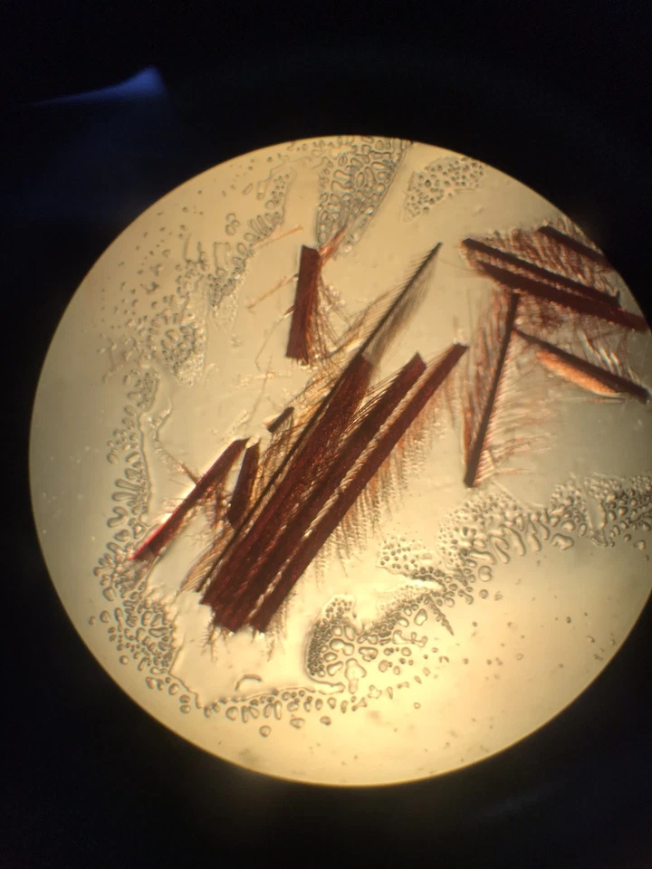 Microscopio de contraste de fase invertida Leica DM IL con 3 objetivos DMIL 090-135,001 Foto 3 de 4