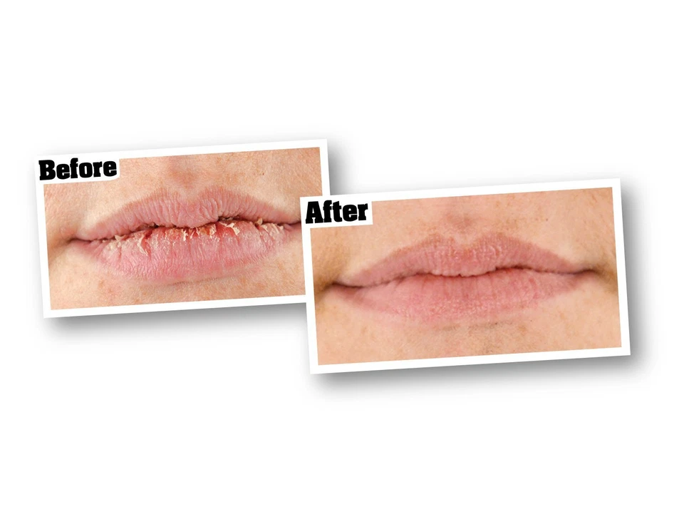 Bálsamo labial reparador de labios sin perfume O'Keeffe's para barra de labios secos agrietados [paquete de 5] Foto 3 de 3