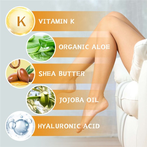 60g Vitamin K Cream Spider Varicose Veins Scars Rosacea Capillaries Dark Circles - Picture 7 of 12