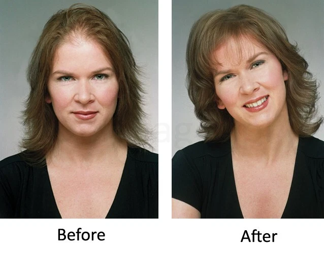 Hair So Real 28g Hair Thickening Building Fibers - MEDIUM BROWN HSR HairSoReal - Image 4 of 4