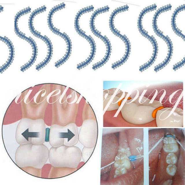 700 Pieces Dental Orthodontic Separate Tie molded separators Blue Color