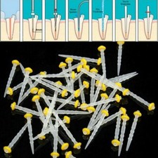 200x Dental Fiber Post Quartz Root Canal Pins 1.0-1.8mm For Core Crown Build-Up