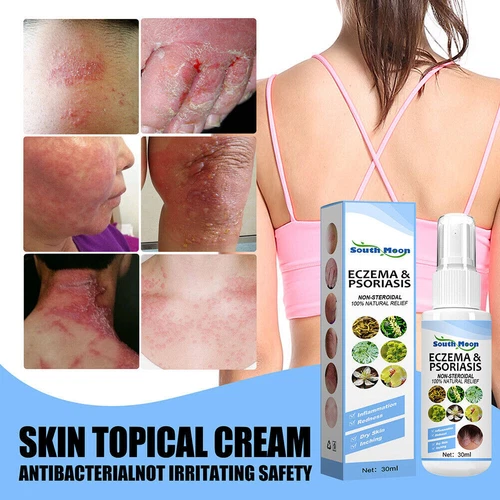 30ml Skin Psoriasis Spray Natural Herb Eczema Treatment Spray Itch Relief New - Picture 4 of 19