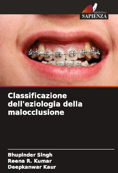 Classificazione Dell'eziologia Della Malocclusione Bhupinder Singh-image