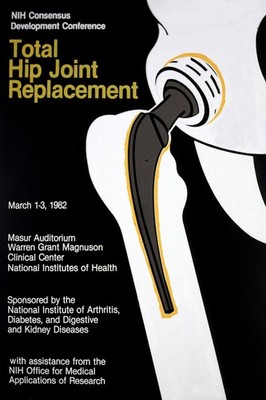   Total Hip Joint Replacement (1982) Poster - 24x36  - Medical Conference Art