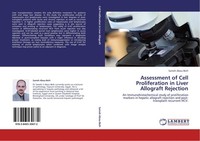 Assessment Of Cell Proliferation In Liver Allograft Rejection Sameh Abou-Beih