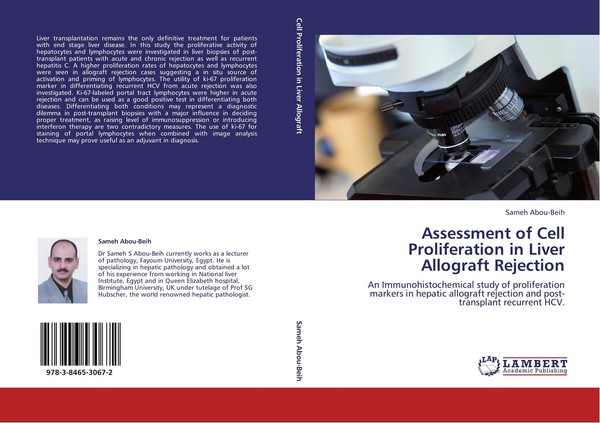 Assessment Of Cell Proliferation In Liver Allograft Rejection Sameh Abou-Beih-image