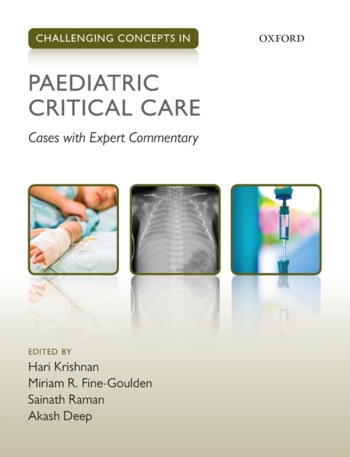 Challenging Concepts in Paediatric Critical Care by B01 (Paperback Book)