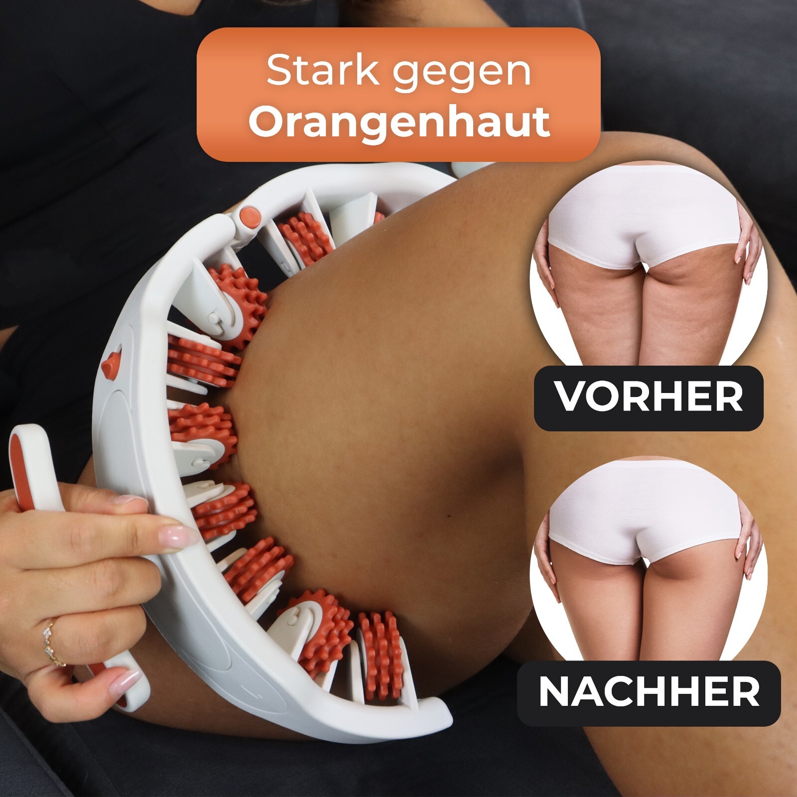 Cellulite Massagegerät EBDTY Anti Cellulite Roller Behandlung Beine, Bauch, Po