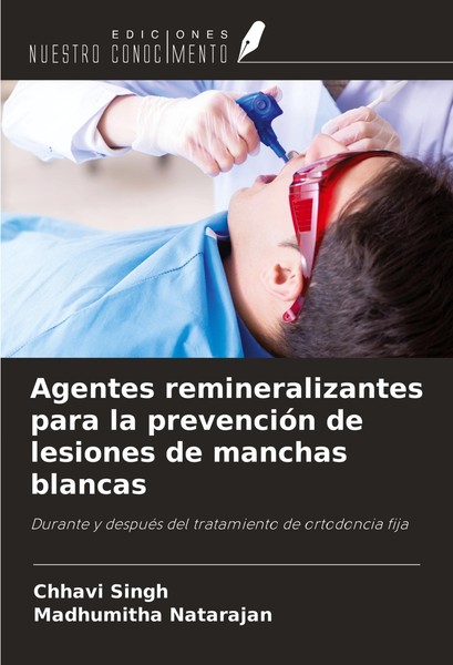 Agentes Remineralizantes Para La PrevencióN De Lesiones De Manchas Blancas Chhav-image
