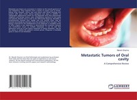 Metastatic Tumors Of Oral Cavity Manish Sharma