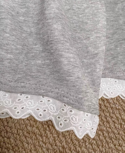 Model wearing high waist wide leg casual shorts with lace trim Loose Fit Short - Picture 5 of 9