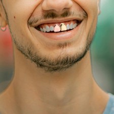 5Pcs Stainless Steel Single Tooth Grill Caps Multi Color Durable Hip Hop Jewelry