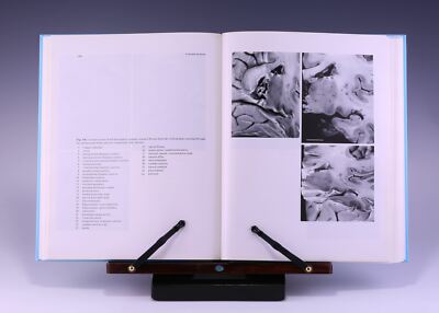 The Human Brain: Surface, Three-Dimensional 2nd Ed by Henri M