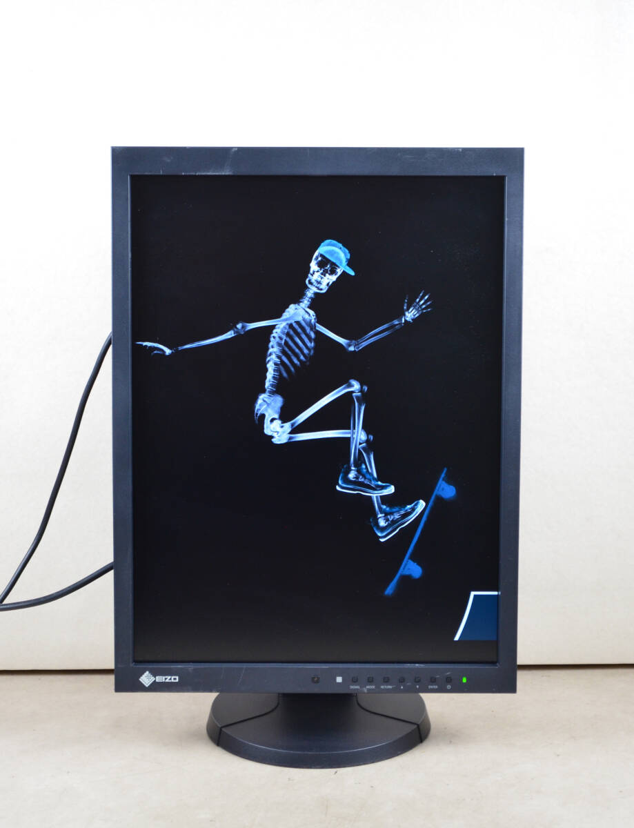 EIZO RadiForce MX215 21-Inch Medical Imaging Wide Display Used | eBay