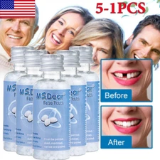 Temporary Tooth Repair Kit Fix Broken Teeth Fill Gaps Denture Damage Glue Filler