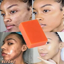 Kojic Acid Soap Face & Body Wash Natural Whitening Lightening Skin Cleans 100g