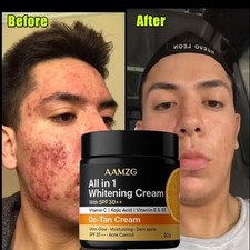 White Glow Skin Whitening And Brightening Gel Cream For Men