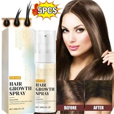 60ml Halo Grow Hair Growth Spray, with Rosemary Biotin Ginseng for Hair Loss 