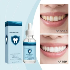 Nano Hydroxyapatite Tooth Cavity Repair Serum ORALHOE Teeth Repair Serum60ml-NEW