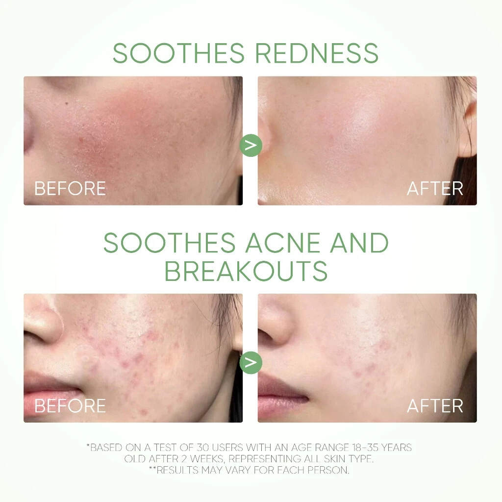 SKINTIFIC Mugwort Acne Clay Mask Stick 40g Reduces Redness Inflammation Pores