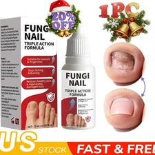 Fungi-Nail Anti-Fungal Liquid Solution Kills Fungus That Can Lead To Nail