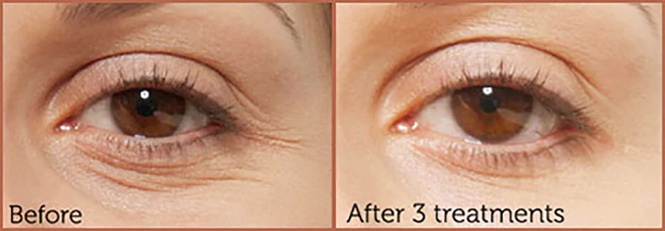 Wrinkle Firming Peptide Facial Serum Hyaluronic Acid Matrixyl Anti Aging Cream - Image 2 of 4