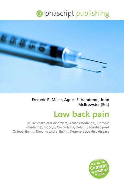 Frederic P. Miller (U. A.) | Low Back Pain | Taschenbuch | Englisch (2026)-image