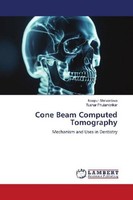 Cone Beam Computed Tomography Tushar Phulambrikar